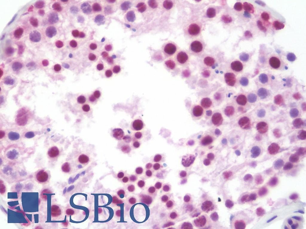 IHC-plus™ Polyclonal Rabbit anti-Human TIMP1 Antibody (aa157-188, IHC, IF, WB)