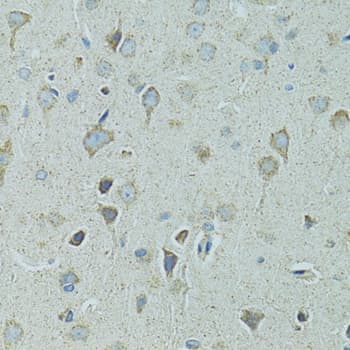 Polyclonal Rabbit anti-Human HSPB1 / HSP27 Antibody (IHC, IF, WB)