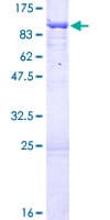 Human UTP6 Protein (Recombinant GST)