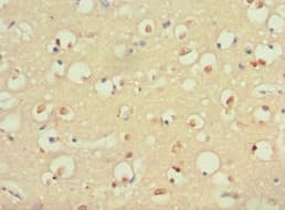 Polyclonal Rabbit anti-Human S100B / S100 Beta Antibody (aa1-92, IHC)