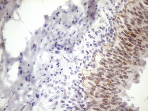 Monoclonal Mouse anti-Human ESRRA / ERR Alpha Antibody (clone OTI2C12, aa1-205, IHC, WB)