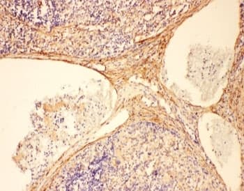 Polyclonal Rabbit anti-Rat Complement C5a Antibody (aa1-18, IHC, WB)