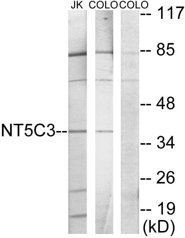 NT5C3A Antibody (aa11-60)