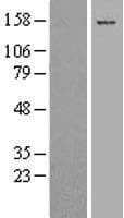 COL17A1 / Collagen XVII Protein (Over-Expression Lysate Myc-DDK (Flag))