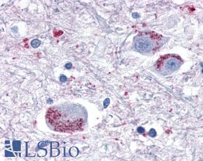 PathPlus™ Polyclonal Rabbit anti-Human GPR80 / GPR99 / OXGR1 Antibody (Extracellular Domain, IHC)