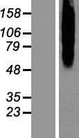 CALCR / Calcitonin Receptor Protein (Over-Expression Lysate Myc-DDK (Flag))