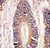 Polyclonal Rabbit anti-Human MLK4 / KIAA1804 Antibody (aa33-62, IHC, WB)