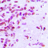 ER Alpha / Estrogen Receptor Antibody (phospho-Ser106)