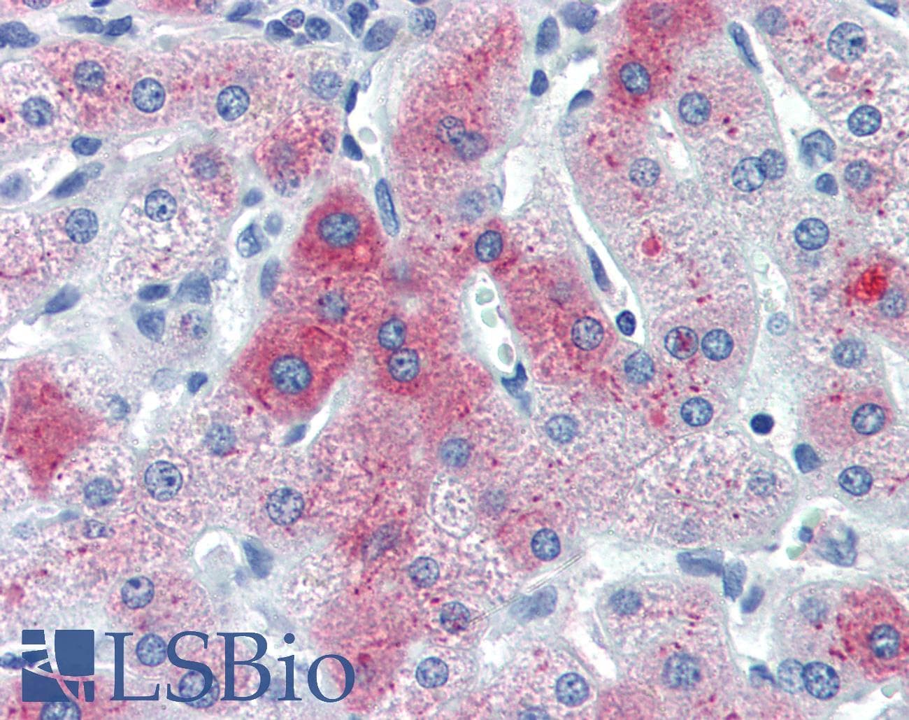 IHC-plus™ Complement C6 Antibody (C-Terminus, clone 056B-214.2.4.2)