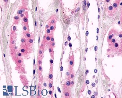 PathPlus™ ADGRV1 / GPR98 Antibody (N-Terminus)