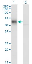 Monoclonal Mouse anti-Human GDI1 Antibody (clone 1H3, WB)