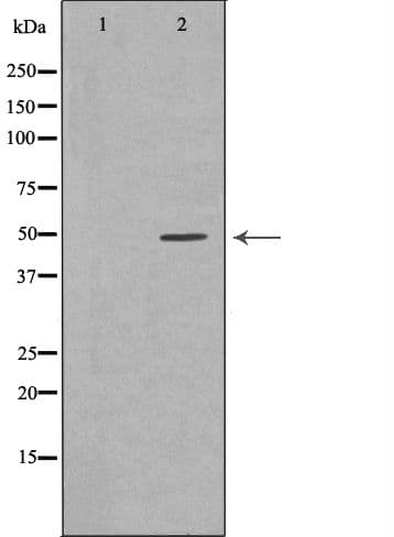 Alpha-1-Antichymotrypsin Antibody