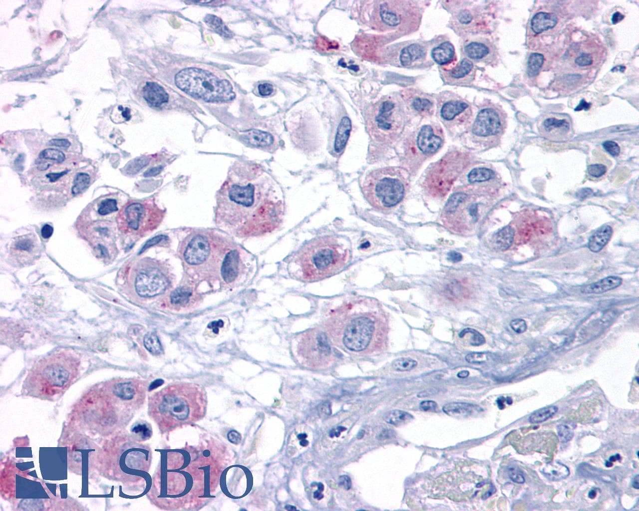 IHC-plus™ ADGRL4 / ELTD1 Antibody (N-Terminus)