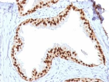 FOXA1 Antibody (clone FOXA1/1512)