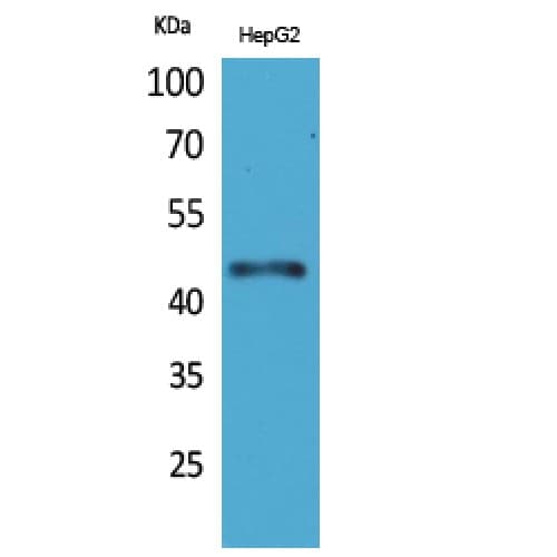 Polyclonal Rabbit anti-Human HOXD3 Antibody (201-250 aa, Internal, WB)