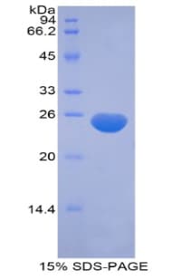 Human MRLC2 / MYL12B Protein (Recombinant His-T7)