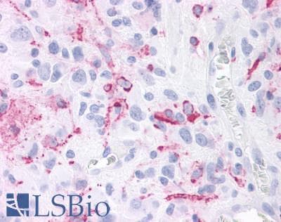 PathPlus™ Polyclonal Rabbit anti-Human RORC / ROR Gamma Antibody (Ligand-binding Domain, IHC)