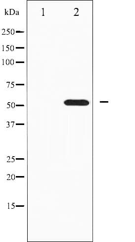 Polyclonal Rabbit anti-Human RPS6KB2 / S6K2 Antibody (phospho-Ser423, IF, WB)