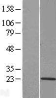 TMEM205 Protein (Over-Expression Lysate Myc-DDK (Flag))