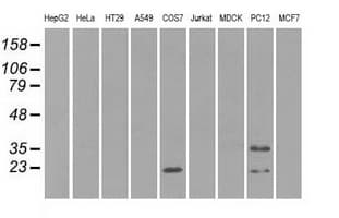 IHC-plus™ CRYAB / Alpha B Crystallin Antibody (clone 6D11)