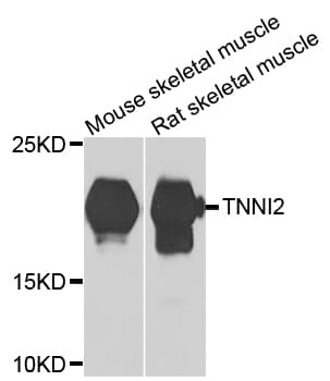 TNNI2 Antibody