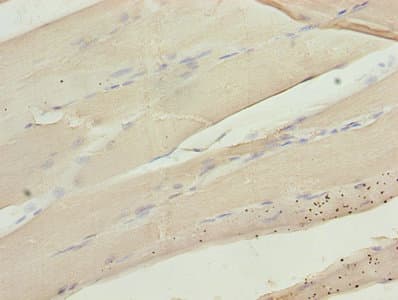 CA3 / Carbonic Anhydrase III Antibody