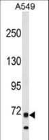 ITK / EMT Antibody (aa25-54)