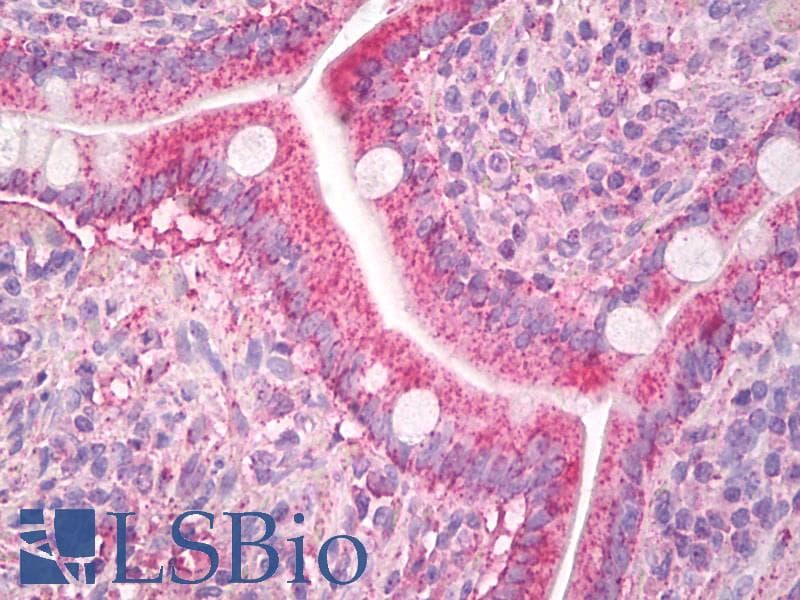 IHC-plus™ CCL8 / MCP2 Antibody