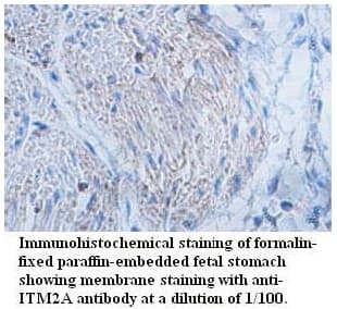 ITM2A Antibody (aa108-253)