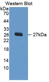 VARS2 / ValRS Antibody (PE)