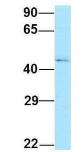 RPL4 / Ribosomal Protein L4 Antibody (C-Terminus)