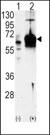 GUCY1A1 / GUCY1A3 Antibody (aa269-300)