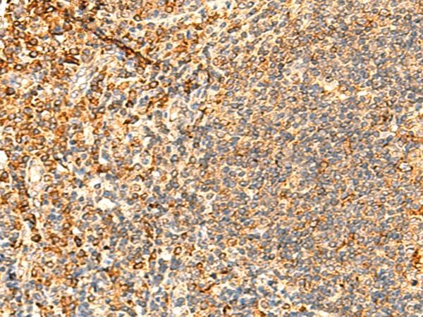 PPM1B Antibody