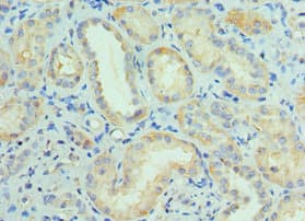 Polyclonal Rabbit anti-Human CUL5 / Cullin-5 Antibody (aa1-300, IHC)