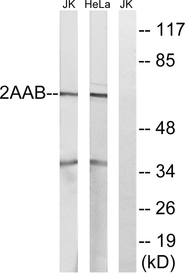 IHC-plus™ PPP2R1B Antibody (aa552-601)