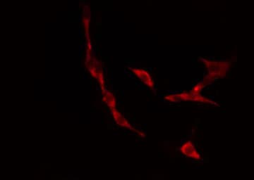 Polyclonal Rabbit anti-Human IP6K3 Antibody (IHC, IF, WB)