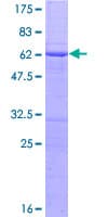 Human RASSF2 Protein (Recombinant GST)
