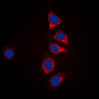 DUSP6 / MKP3 Antibody (Internal)