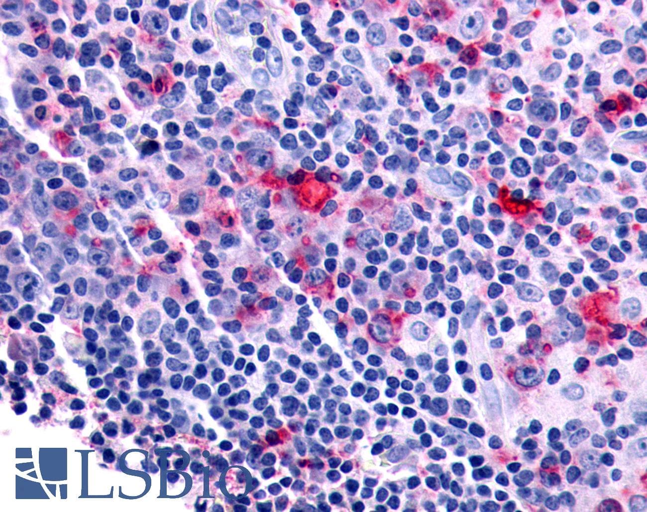 PathPlus™ FZD8 / Frizzled 8 Antibody (N-Terminus)