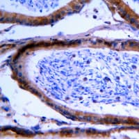 GCNT7 Antibody (C-Terminus)