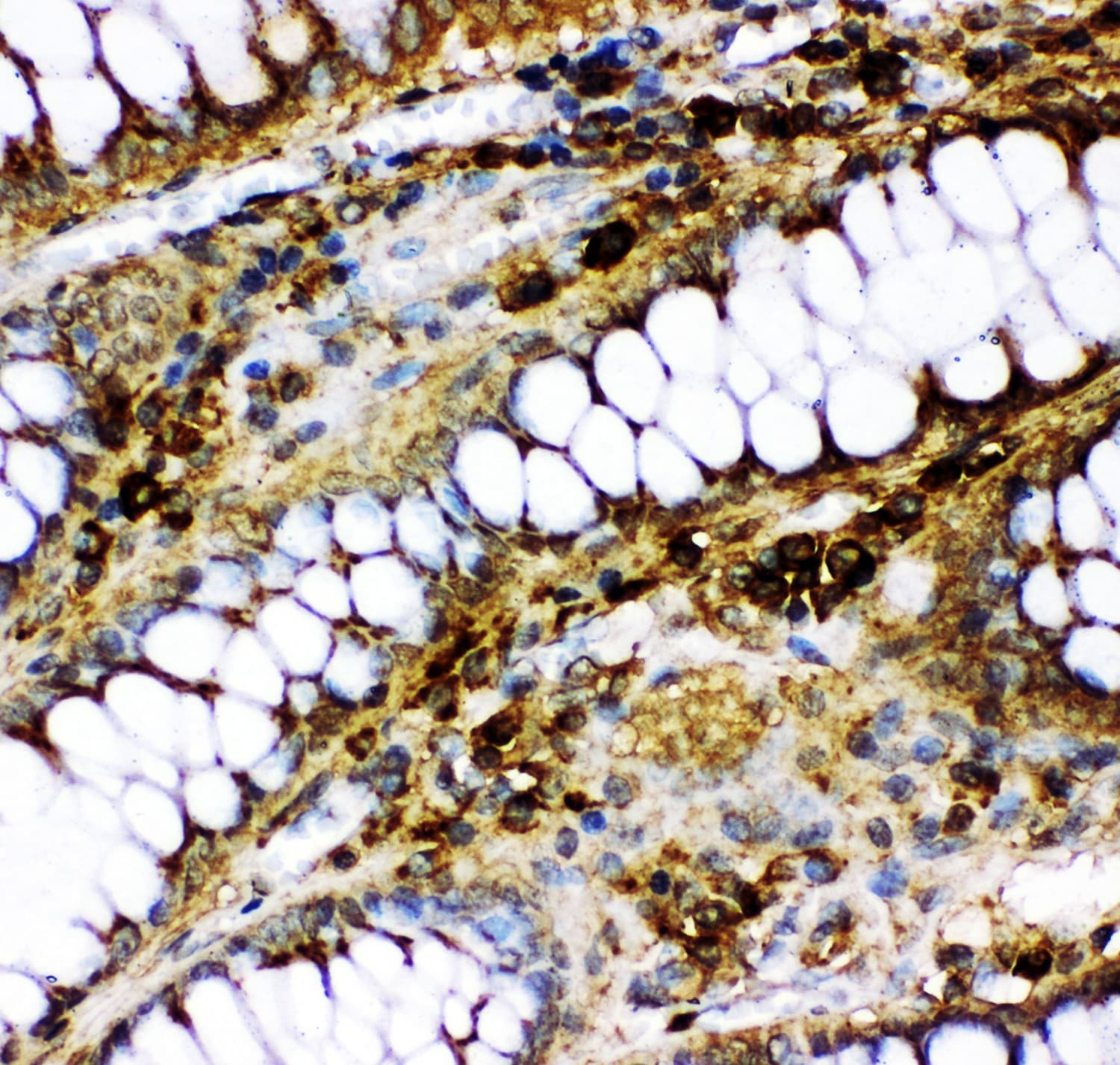 Polyclonal Rabbit anti-Human TP73 / p73 Antibody (aa1-198, IHC, WB)