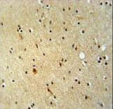 Polyclonal Rabbit anti-Human ZNF536 Antibody (aa203-231, IHC, WB)
