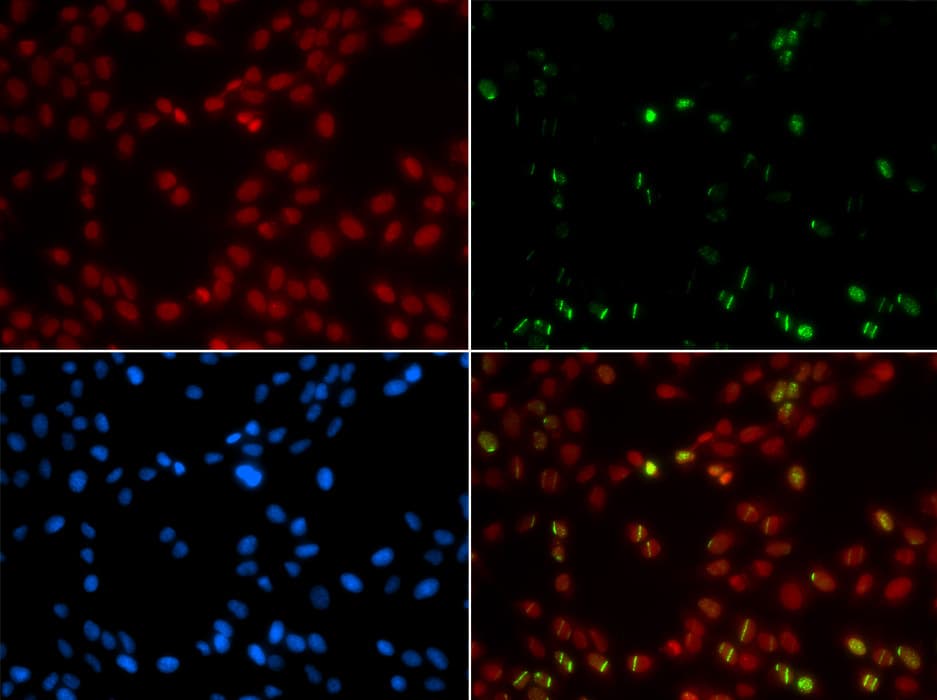SUMO1 / SMT3 Antibody