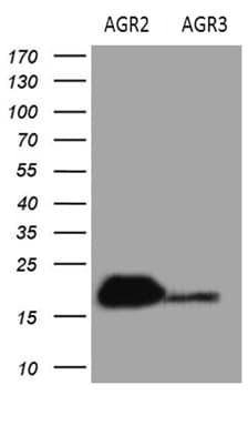 AGR2 Antibody (aa21-175, clone OTI5E10)