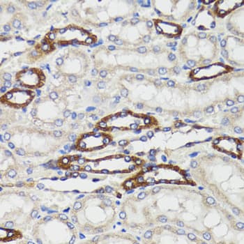Polyclonal Rabbit anti-Human BAP29 / BCAP29 Antibody (IHC, WB)