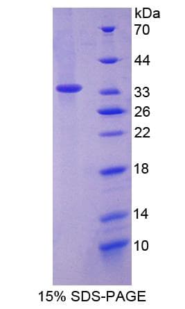 Human LMAN2 / VIP36 Protein (Recombinant His-S)