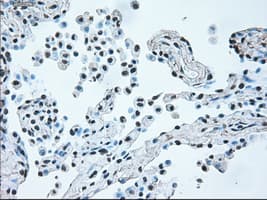 BRAF / B-Raf Antibody (clone OTI4C5)