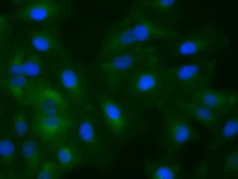 KRT8 / CK8 / Cytokeratin 8 Antibody (clone OTI2E4)