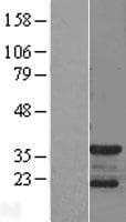 Human CDK5R1 Protein (Over-Expression Lysate Myc-DDK (Flag))