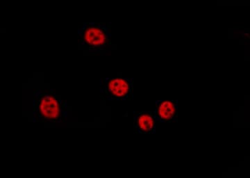 Histone H4 Antibody (Acetyl-Lys12)